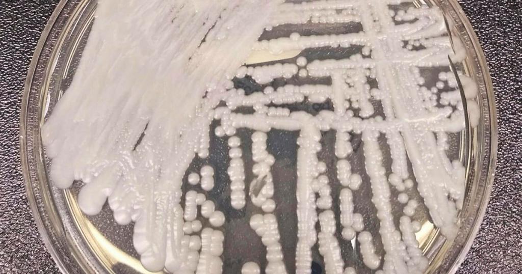 CDC report identifies two new potentially deadly superbugs